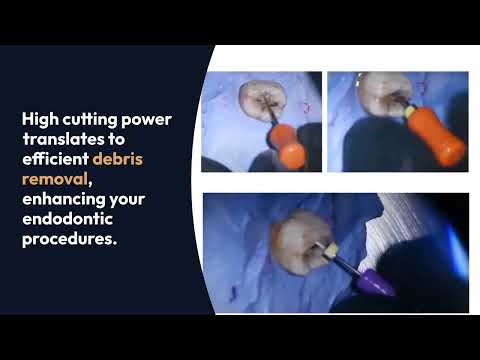 Waldent Pro-Taper Gold Hand File 21mm Assorted SX-F3  - 2