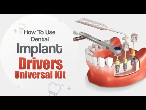 Waldent Dental Implant Prosthetic Universal Kit  - 2