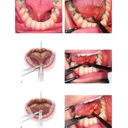 Waldent Hemostats ( Artery Forcep)  - 16