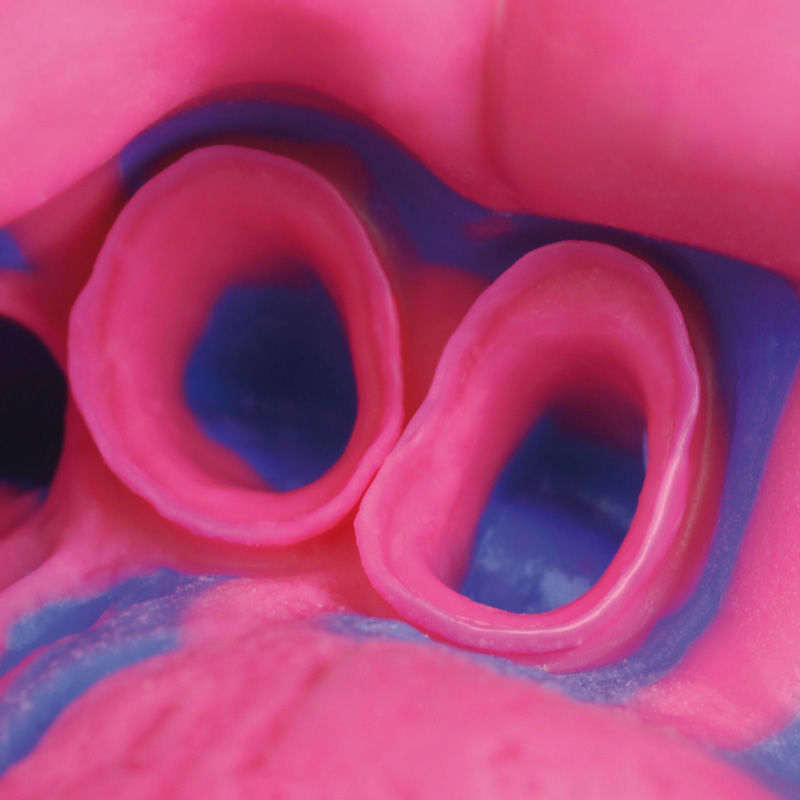 Zhermack Hydrorise Putty & Light Body Combo