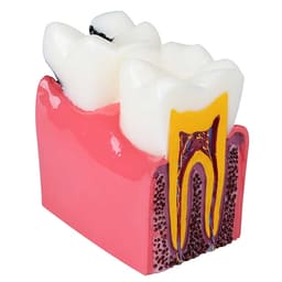 iDENTical Caries V/S Healthy Teeth Model M4021 - 11
