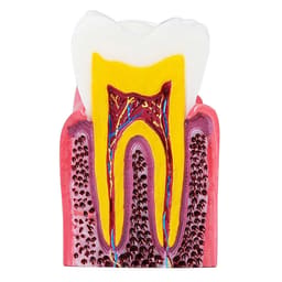 iDENTical Caries V/S Healthy Teeth Model M4021 - 12