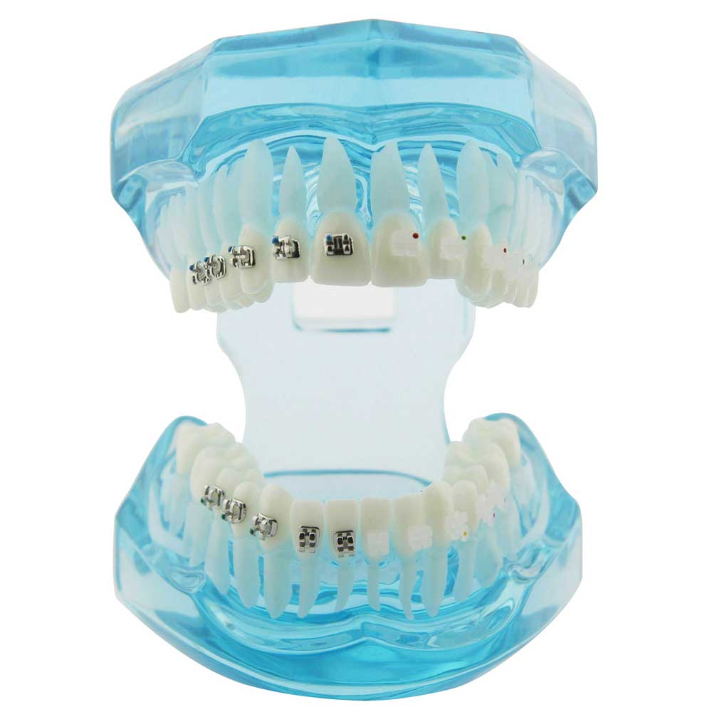 iDENTical Half Metal and Half Ceramic Brackets Orthodontic Models M3003