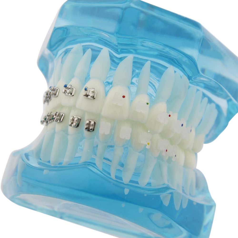 iDENTical Half Metal and Half Ceramic Brackets Orthodontic Models M3003