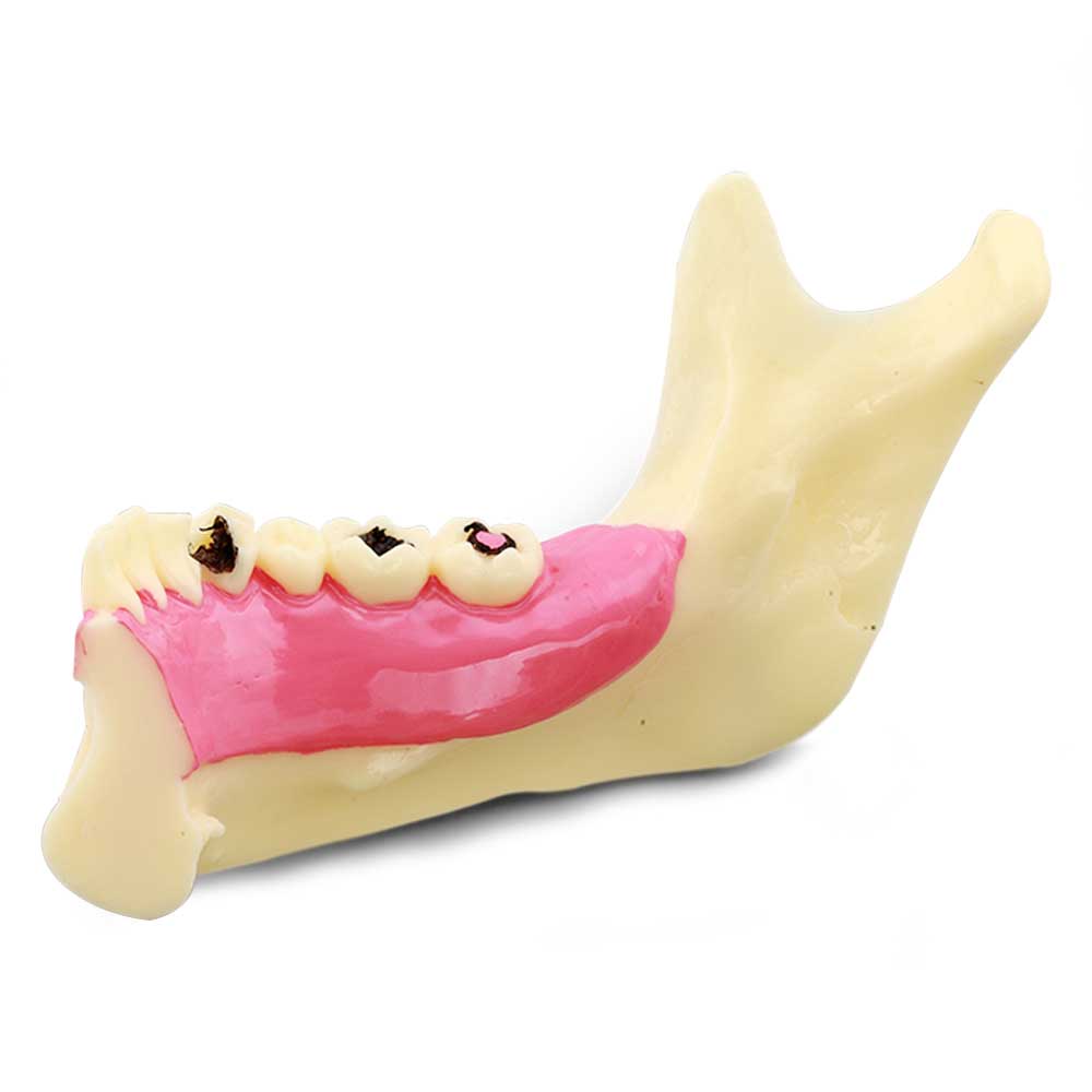 iDENTical Mandible Bone Model M4014
