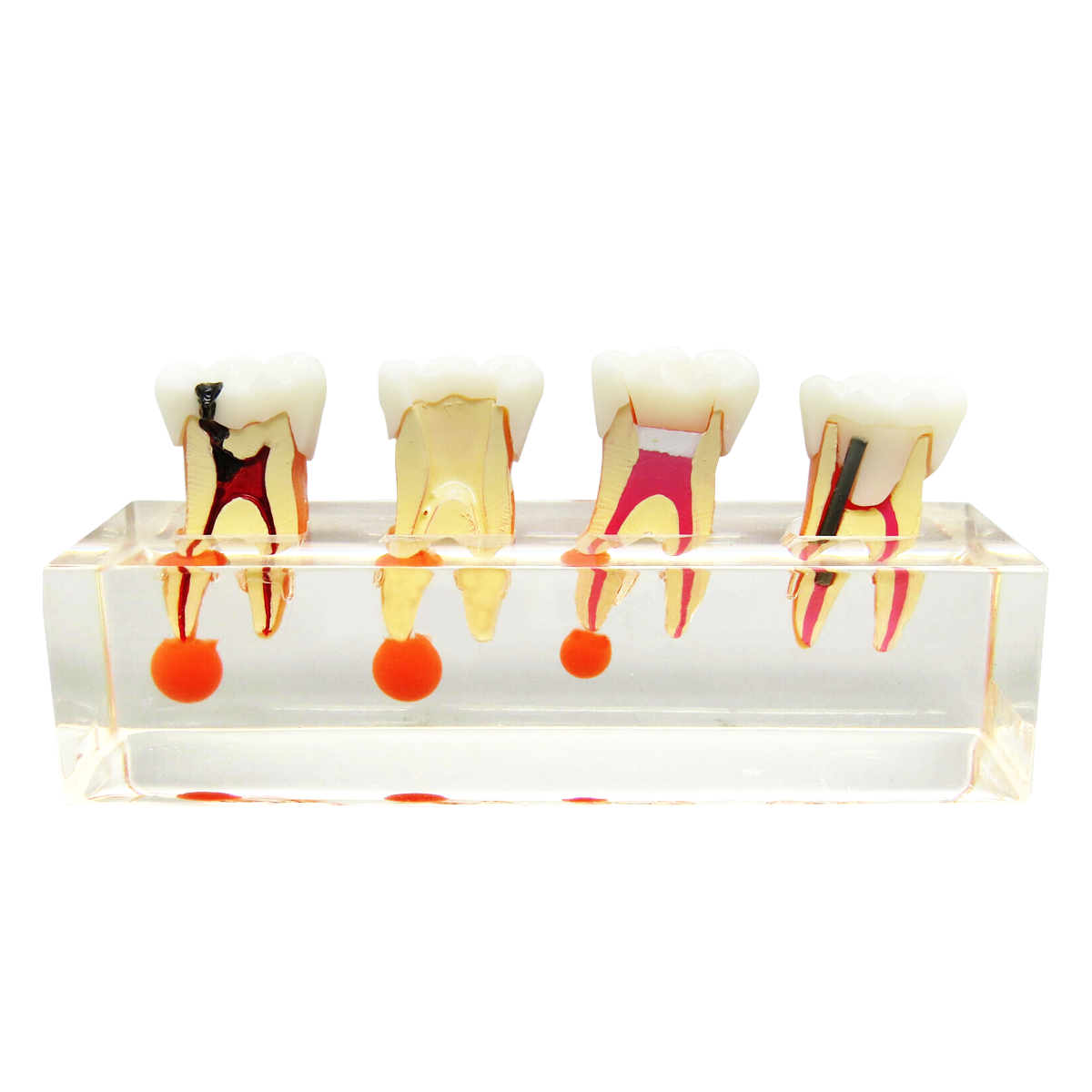 iDENTical Study Model Root Canal Treatment M 4018