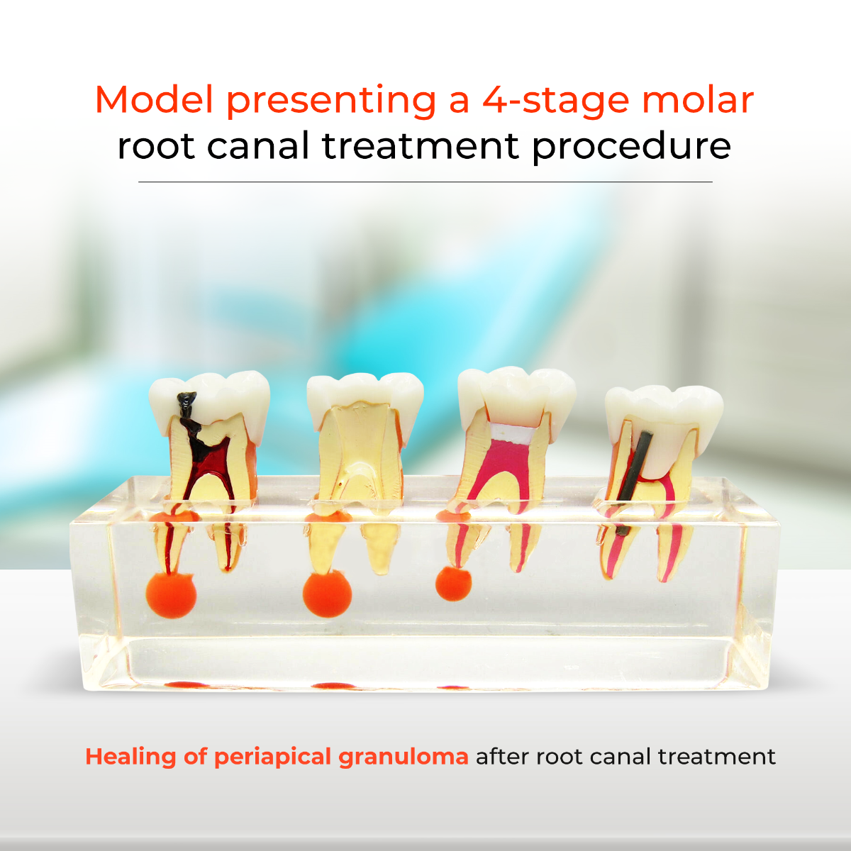 iDENTical Study Model Root Canal Treatment M 4018