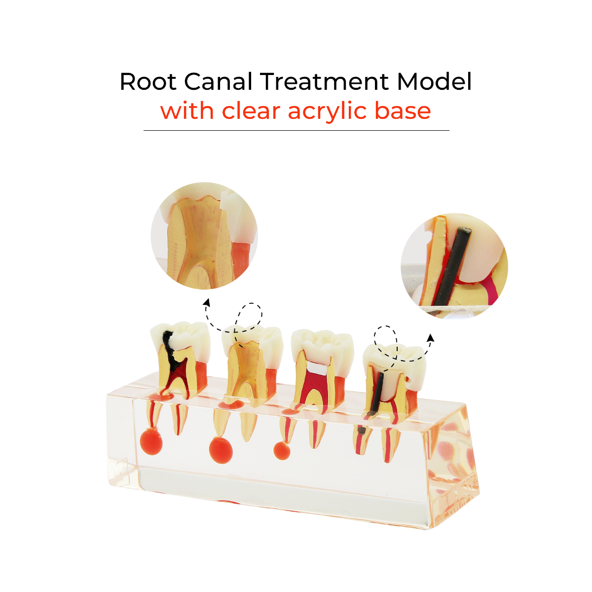 iDENTical Study Model Root Canal Treatment M 4018