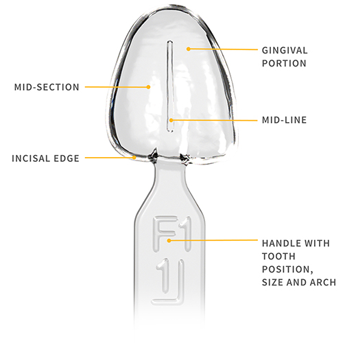 Waldent MyVeneer Composite Template System