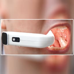 Waldent Maxbite Intraoral Lighting - 18