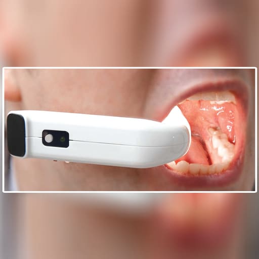 Waldent Maxbite Intraoral Lighting