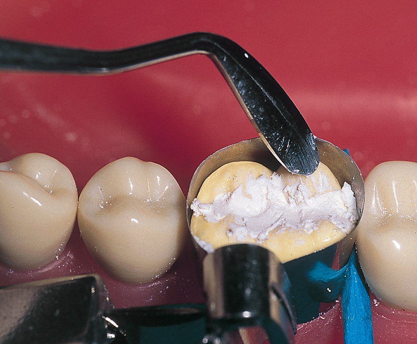 Gdc Conservative Kit Instruments Set Of 19 In Pouch (CIP19)