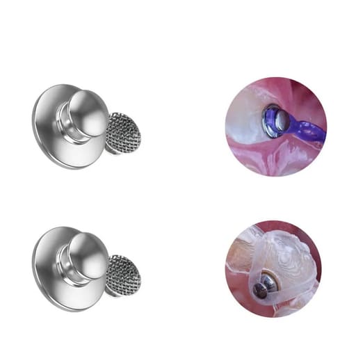 U Ortho Bondable Lingual Buttons Round (10/pk)