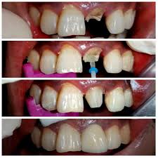 Medicept Dental Self Post