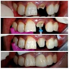 Medicept Dental Self Post - 7