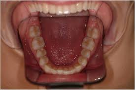 Capri Double Sided Stainless Steel Photographic Mirror - Adult 1/pk