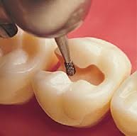 Mani Diamond Airotor Burs - Special (Extra) Shape / Ex Series