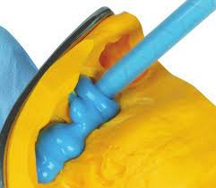 Zhermack Elite Hd+ Soft Putty And Light Body