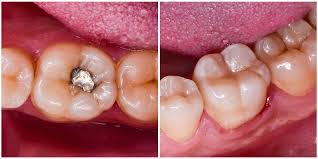 Maarc Mercury Liquid