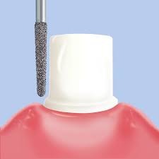 Mani Diamond Airotor Burs - Straight Round End / Sr Series