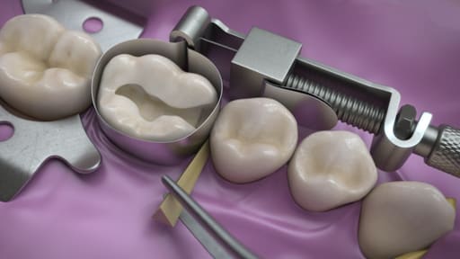Waldent Tofflemire Retainer 8/105