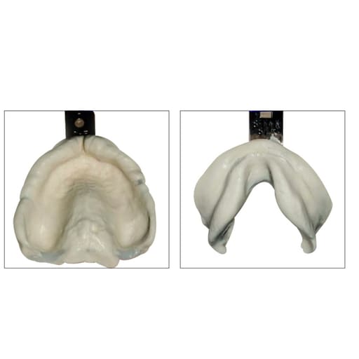 Waldent Edentulous Non-Perforated Impression Trays K18/2
