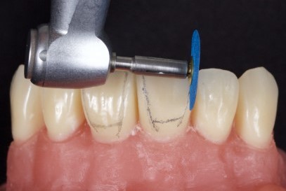 Tor Vm Finishing & Polishing Kit (1.021)