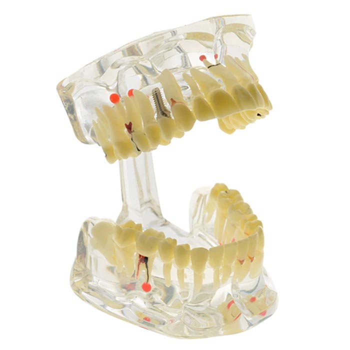 iDENTical Adult Pathologies Model M4001-1