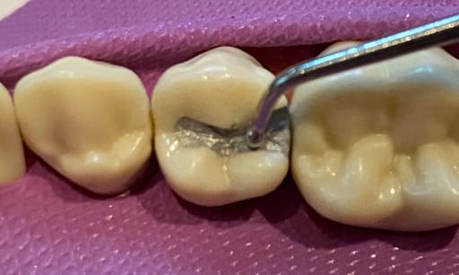 GI Dental Ball Burnisher