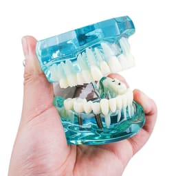 iDENTical All In One Implant Models M2001 - 4