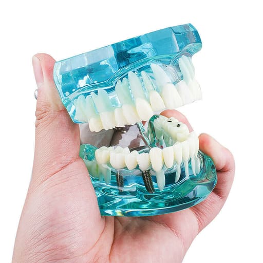 iDENTical All In One Implant Models M2001