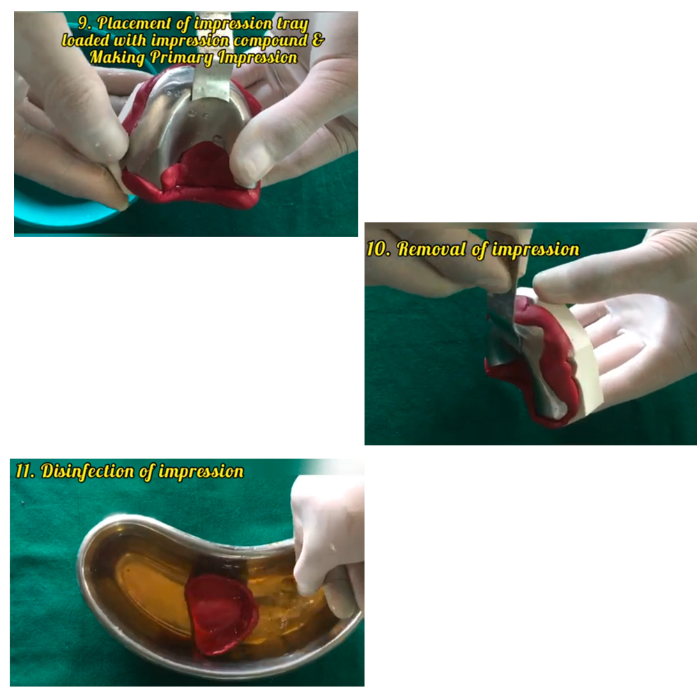 Maarc Impression Compounds