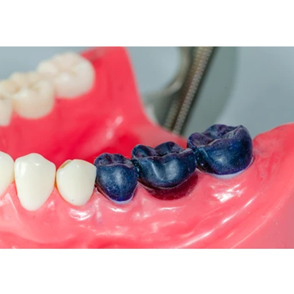 Maarc Inlay/Onlay Wax Sticks