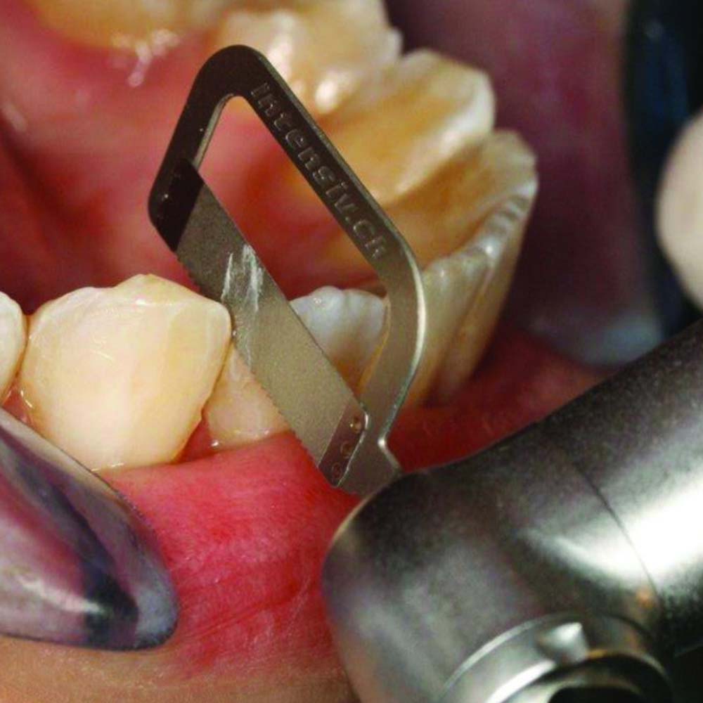 Waldent Orthodontic Inter-Proximal Reduction (IPR) Kit