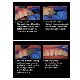 Julldent Inter Proximal Discs Set of 3 - 3