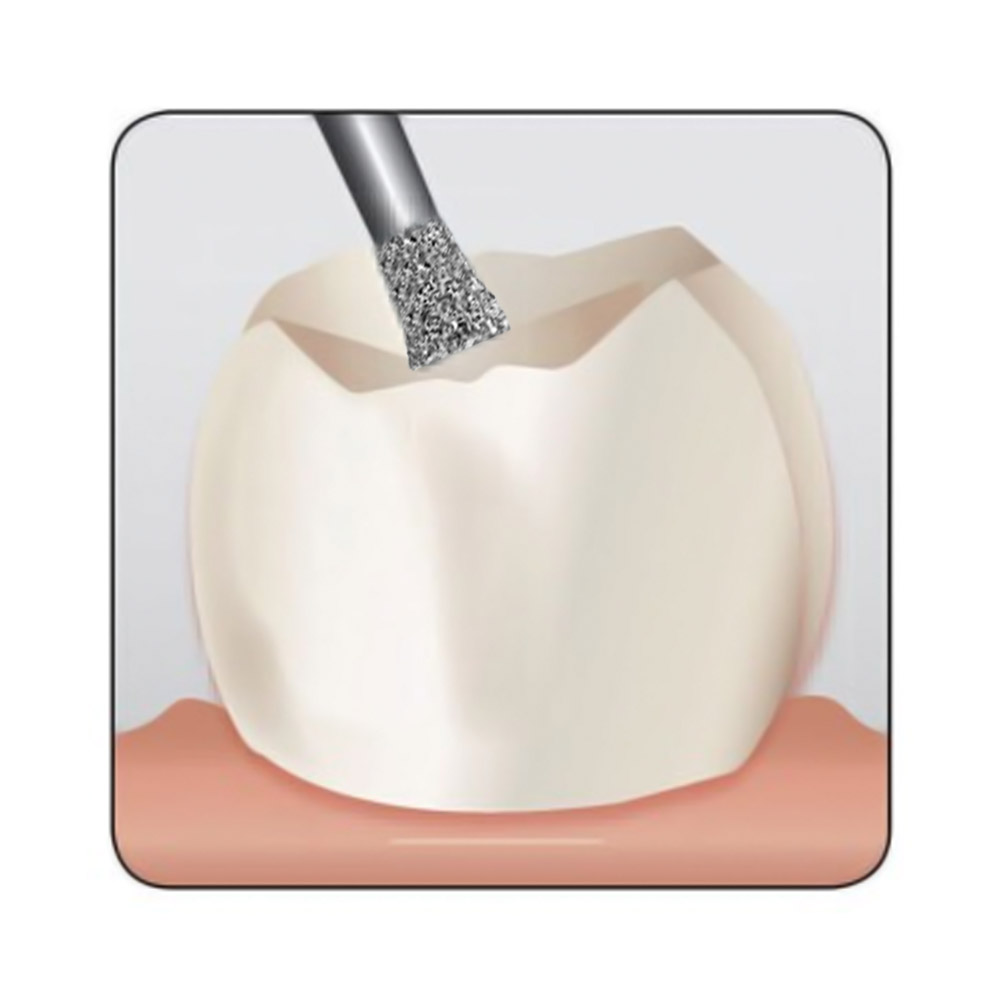 Frank Dental Straight Inverted Cone Diamond Bur FG -SI & DI (Made in Germany)