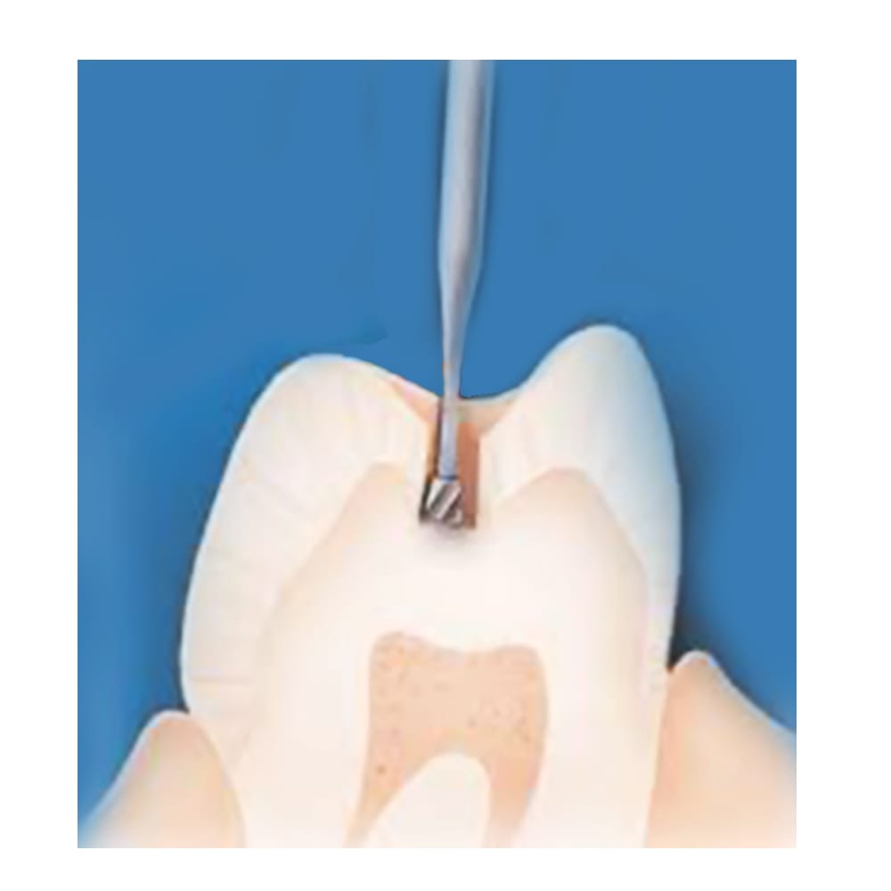 Frank Dental Carbide Bur C.2.023.HP -Pk/1 (Made in Germany)