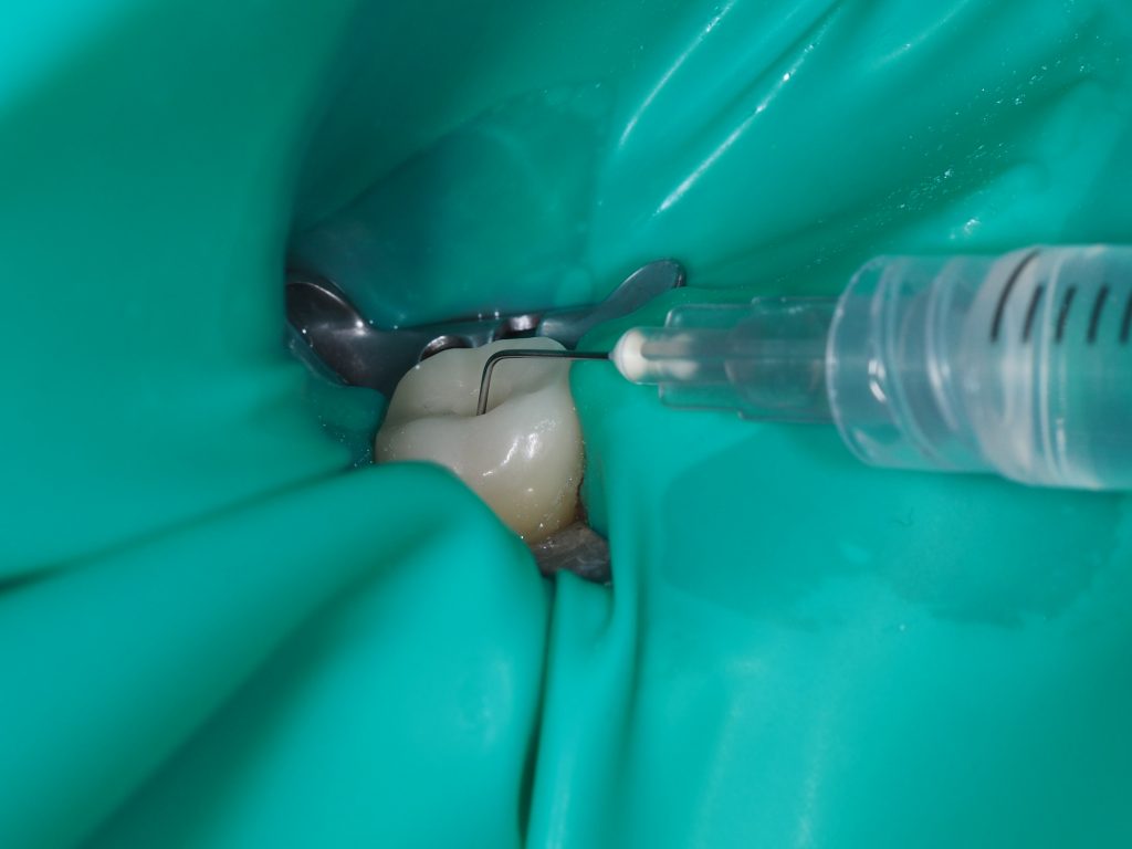 Maarc Chloro-HX 2%  (3010/250)