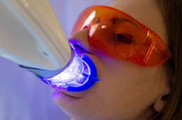 Oro Protective Eyewear Goggles - 6