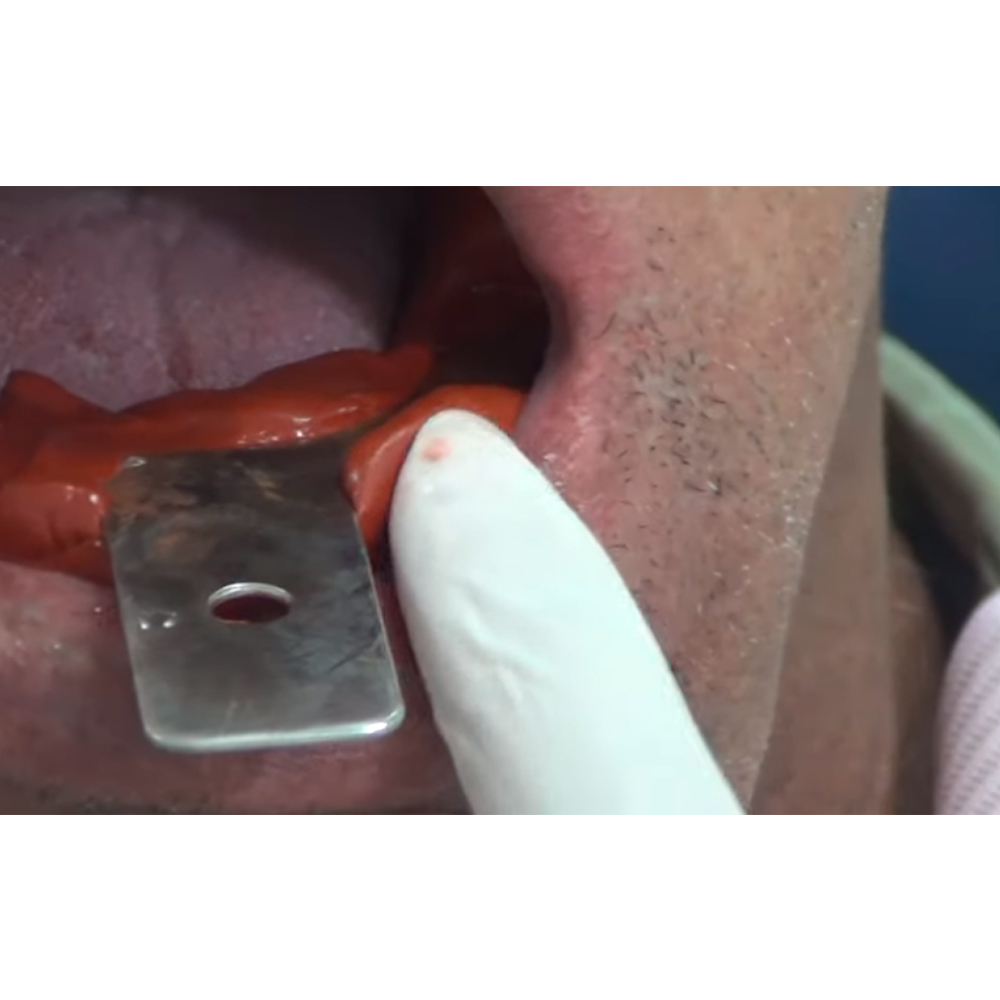 GDC Edentulous Non-Perforated Impression Trays Lower #3 (ITRLEDNPL3)