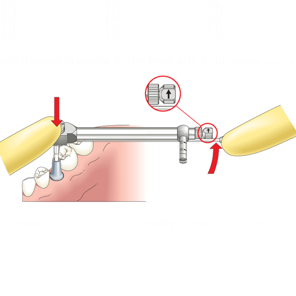 DentalPlant Implant Torque Wrench Ratchet 10–70 Ncm