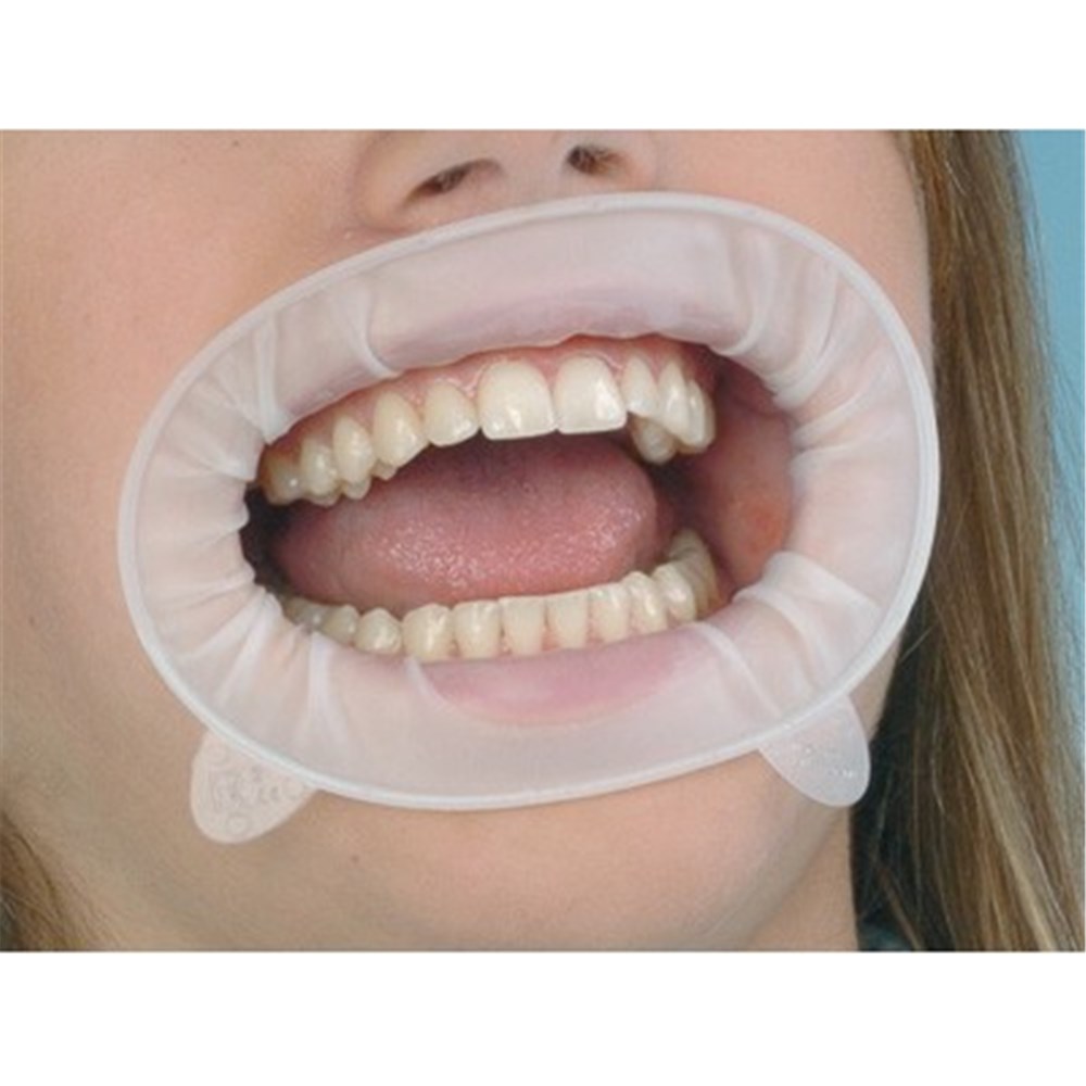 Ivoclar Optragate Cheek And Lip Retractor 