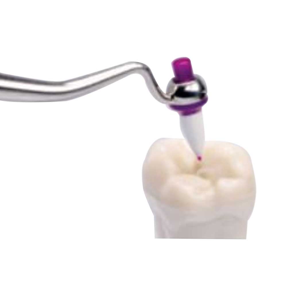 Ivoclar Vivadent OptraSculpt Starter Kit & Refills