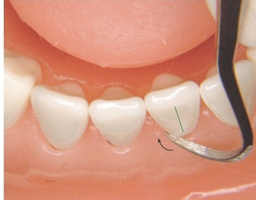 GDC Perio Scalers Set of 8 (PSP8)