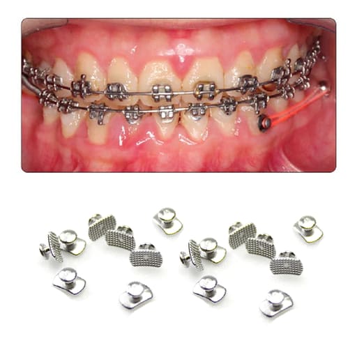 Ortho Direct Lingual Buttons