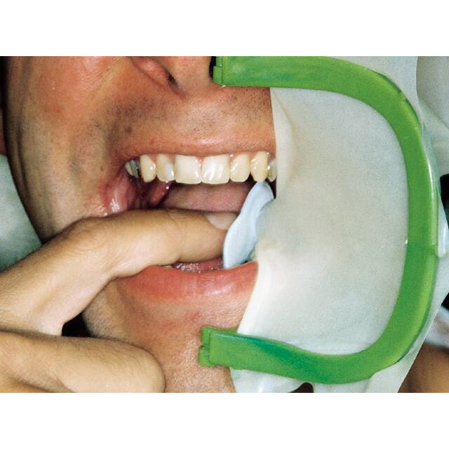 ET Dental Rubber Dam Frames