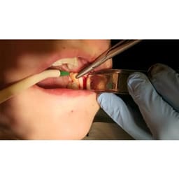 GDC Kilner Retractor C Shape (KRC) - 5