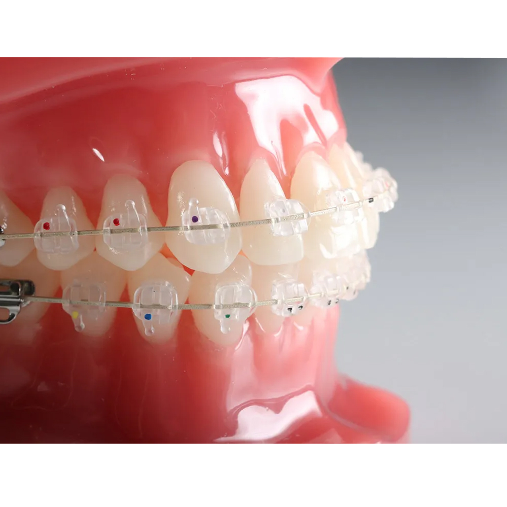 Koden Supreme MBT Ceramic Bracket Kits