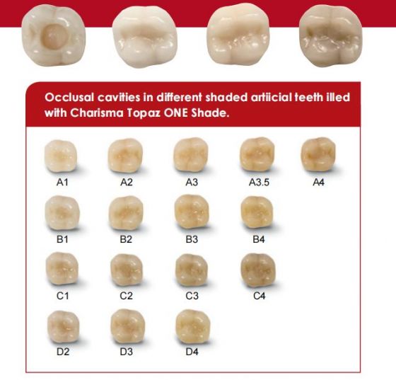 Kulzer Charisma Topaz One Shade Resin Based Restorative Composite Kit