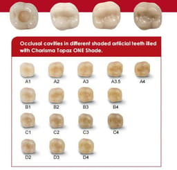 Kulzer Charisma Topaz One Shade Resin Based Restorative Composite Kit - 5